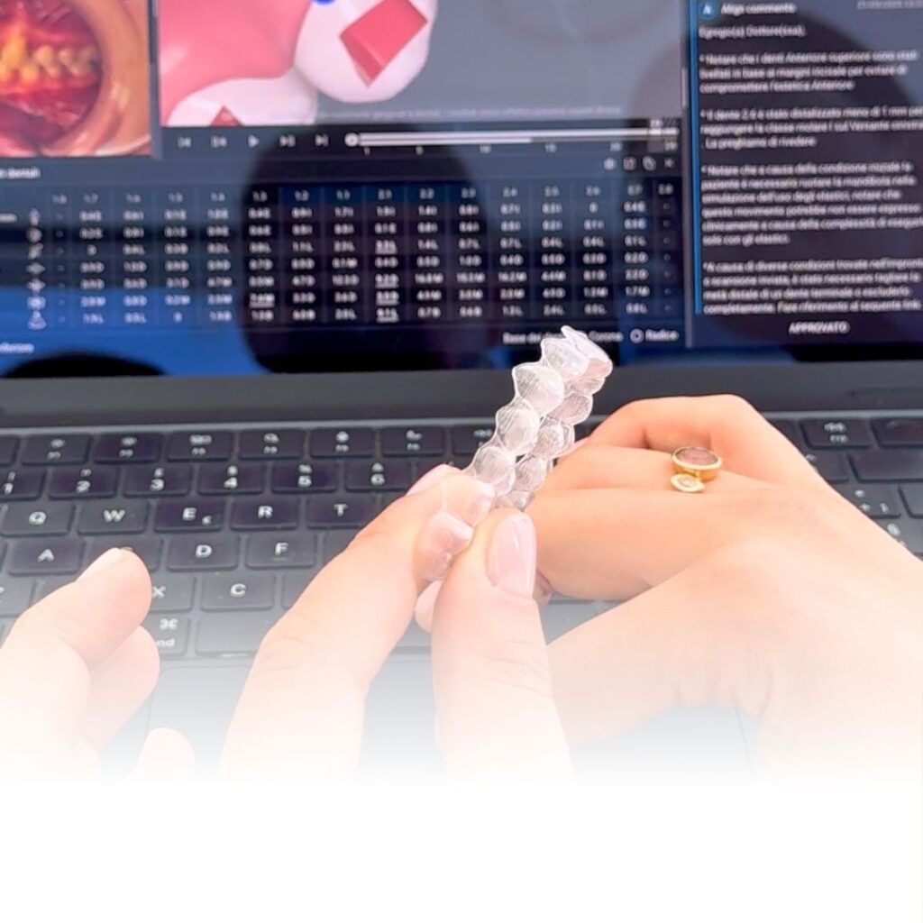 mascherine trasparenti o apparecchio tradizionale