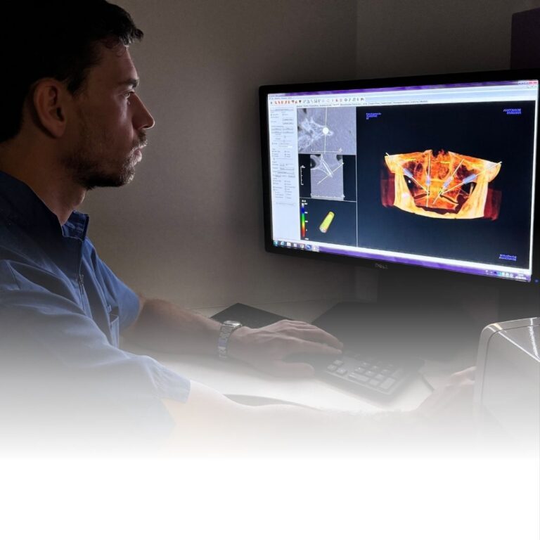 CHIRURGIA - gnatologo a Borgomanero estrazione dente del giudizio a Borgomanero