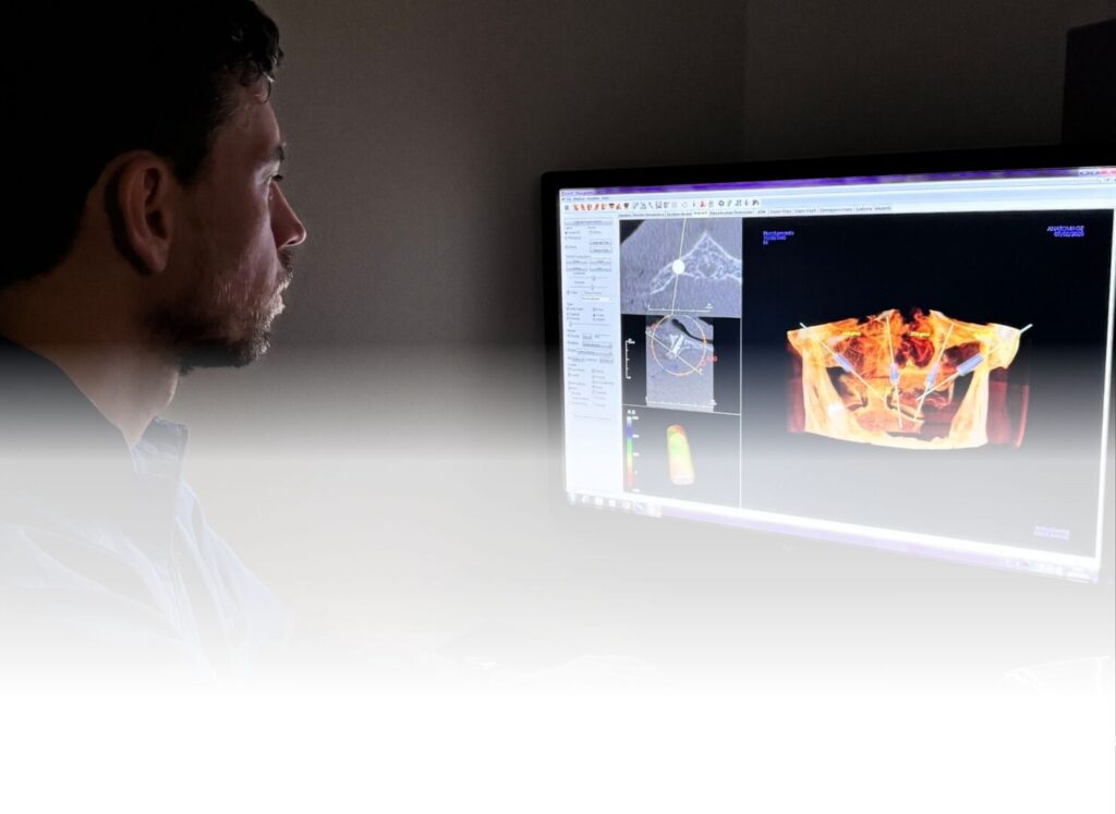 Impianto dentale e dolore: quanto può durare dopo averlo messo? 2 Impianto dentale e dolore