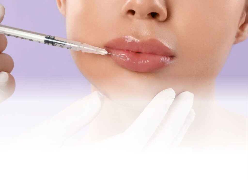 Quanto dura il filler alle labbra