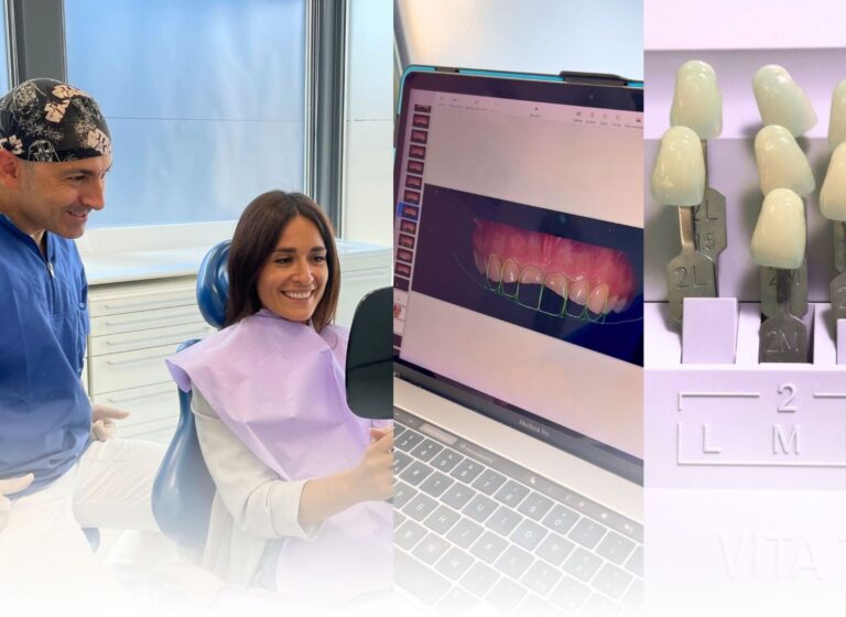 Faccette dentali a Borgomanero (2) Image description