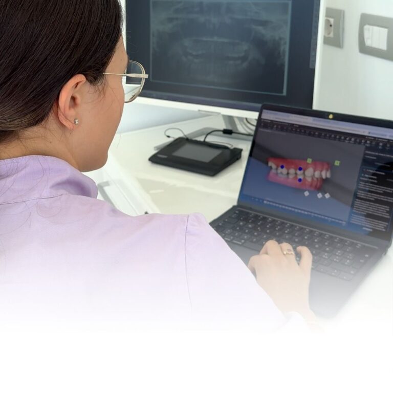 GNATOLOGIA - dente del giudizio a Borgomanero gnatologo a Borgomanero