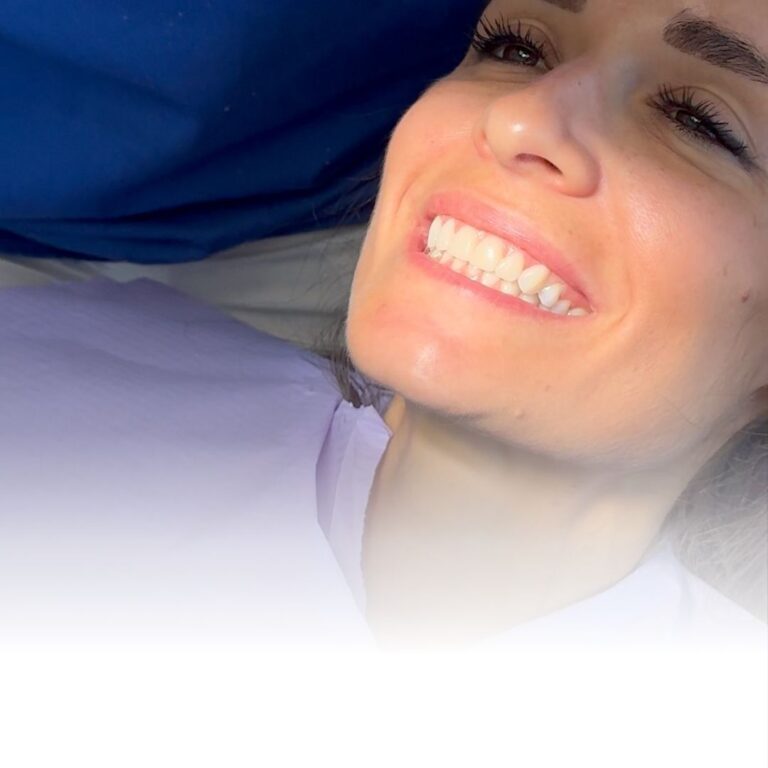 SBIANCAMENTO - sbiancamento a Borgomanero sbiancamento dentale a Borgomanero